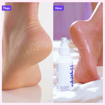 Alum Infused Phitku Foot Spray