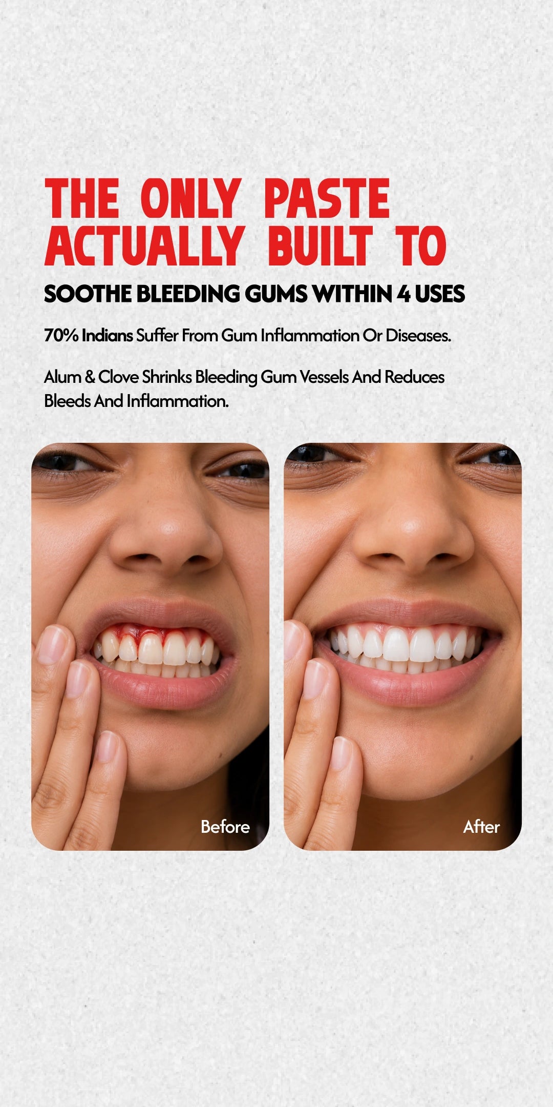 Mouth Paste - Pack Of 2